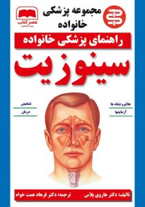 سینوزیت